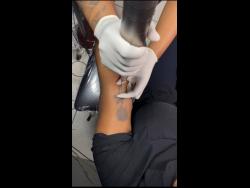 Erasing the past, Candice Davis, owner of NeedleZ Piercing and Tattoo conducts a laser tattoo removal procedure.