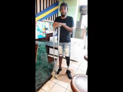 Hakim Bond standing on his prosthetic leg.