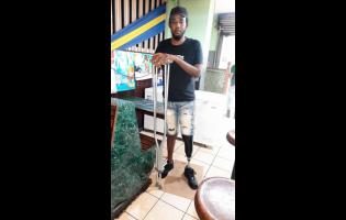 Hakim Bond standing on his prosthetic leg.