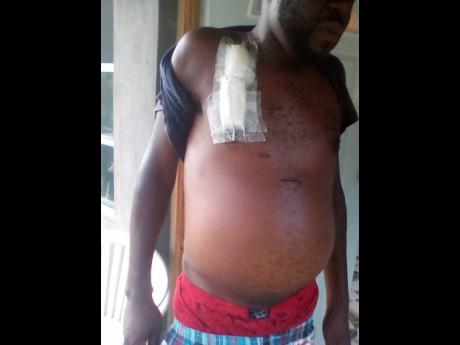 Wallace’s condition is getting worse.