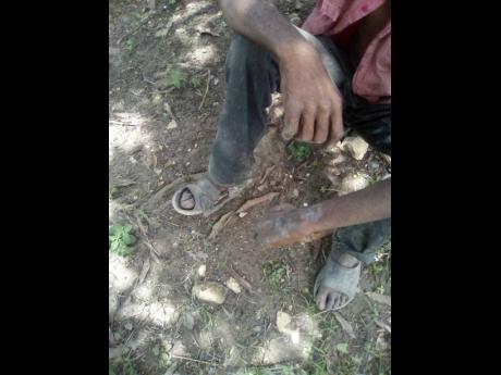 Clement climbed a light post in the community and was badly burnt on his arms and feet.