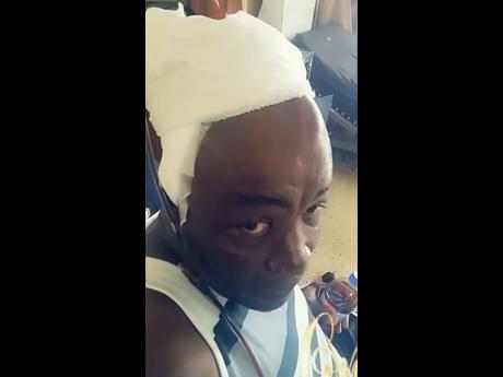 Roderick Frazer with his head bandaged following one of his two operations.