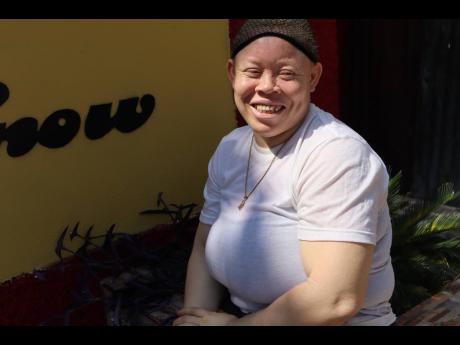 Nichola Levine was called names such as ‘Dundus’ and ‘Ghost’ when she was growing up. 