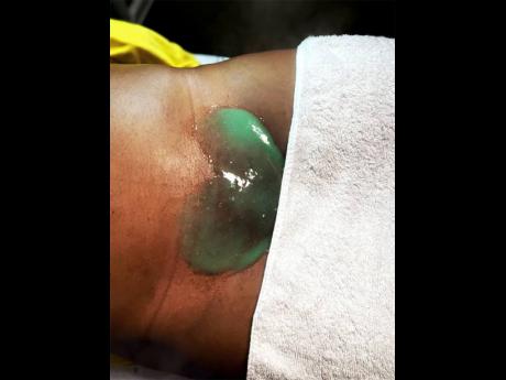 The vagacial is among the most sought after genital grooming procedures.