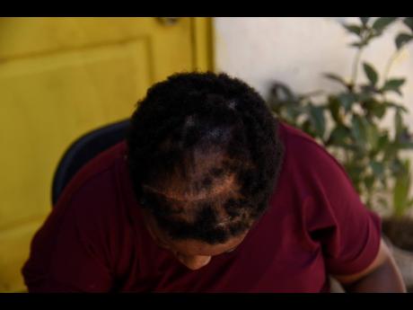 Townsend shows the scar from her surgery.