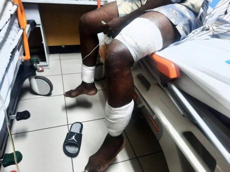 One of the security guards injured in Sunday’s robbery in Portmore, St Catherine.