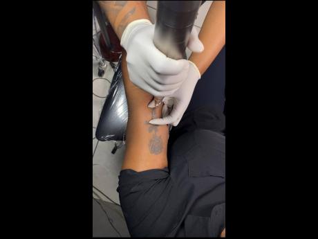 Erasing the past, Candice Davis, owner of NeedleZ Piercing and Tattoo conducts a laser tattoo removal procedure.