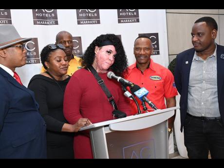 Burn victim Alecia King speaks during a press conference held at the  AC Hotel in Kingston yesterday.