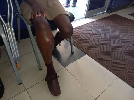 Credit: KALLEJHAY TERRELONGE Teairra’s knee is badly swollen.