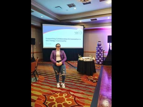 Morgan-Forrester attending the World Vitiligo Day Conference in the US.