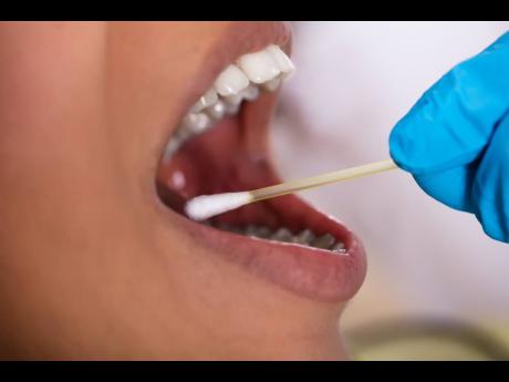 Credit: File A woman has a swab taken from her cheek for a DNA test.