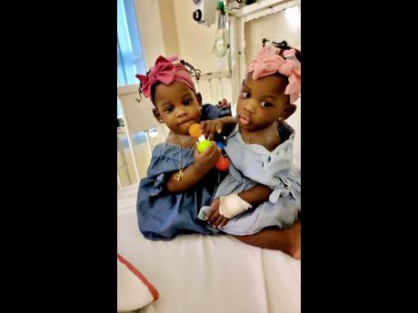 Conjoined twins, Azaria and Azora Elson.