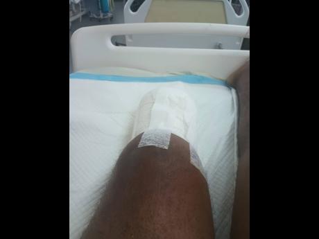 Credit: Contributed At first, Bond lost parts of his foot, before having the lower half of his left leg amputated.