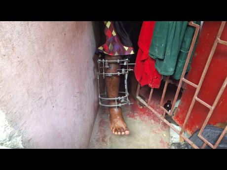 Credit: Almando Smith Garfield Webb shows his injured leg.