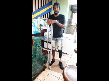 Hakim Bond standing on his prosthetic leg.